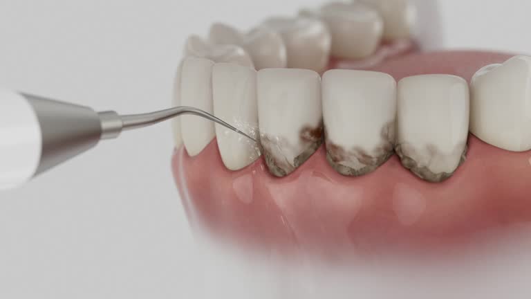 Trusted Emergency Dentist service in Marlboro Meadows, MD - Dentist Open Now
